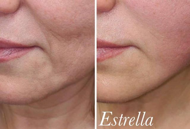 90595801 3428856367131053 462258787378528256 n